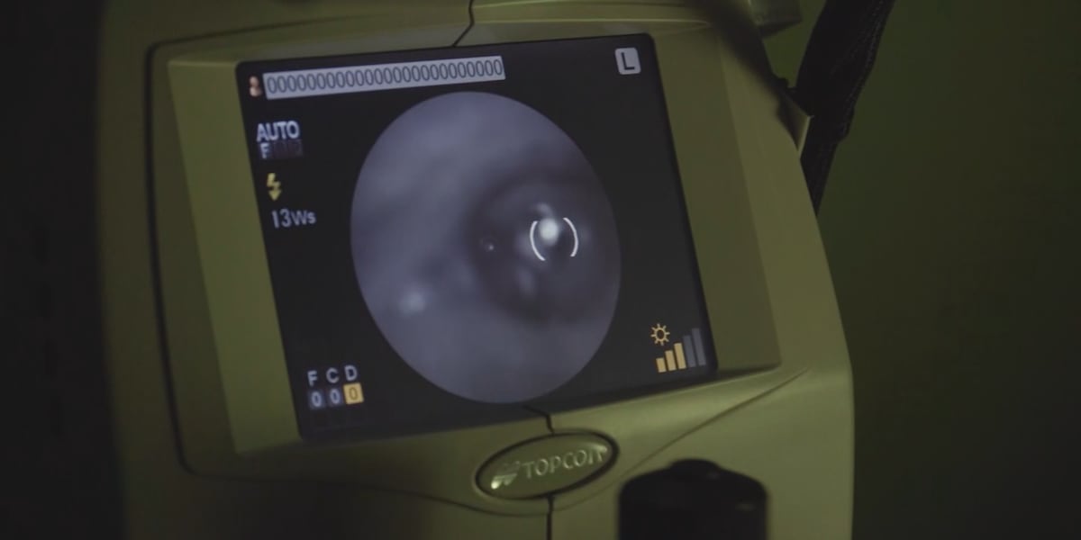 HOMETOWN HEALTH: UVA Health offers first-in-Virginia treatment for rare eye cancer