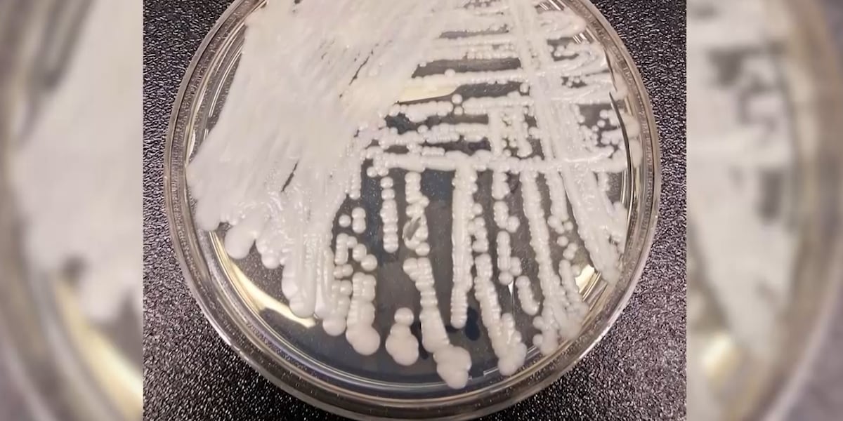 HOMETOWN HEALTH: Fungus spreading across the U.S., CDC calling it an urgent threat