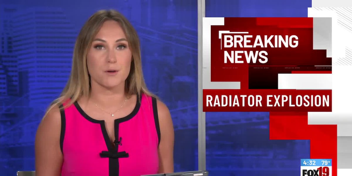 Man burned, hospitalized in radiator explosion